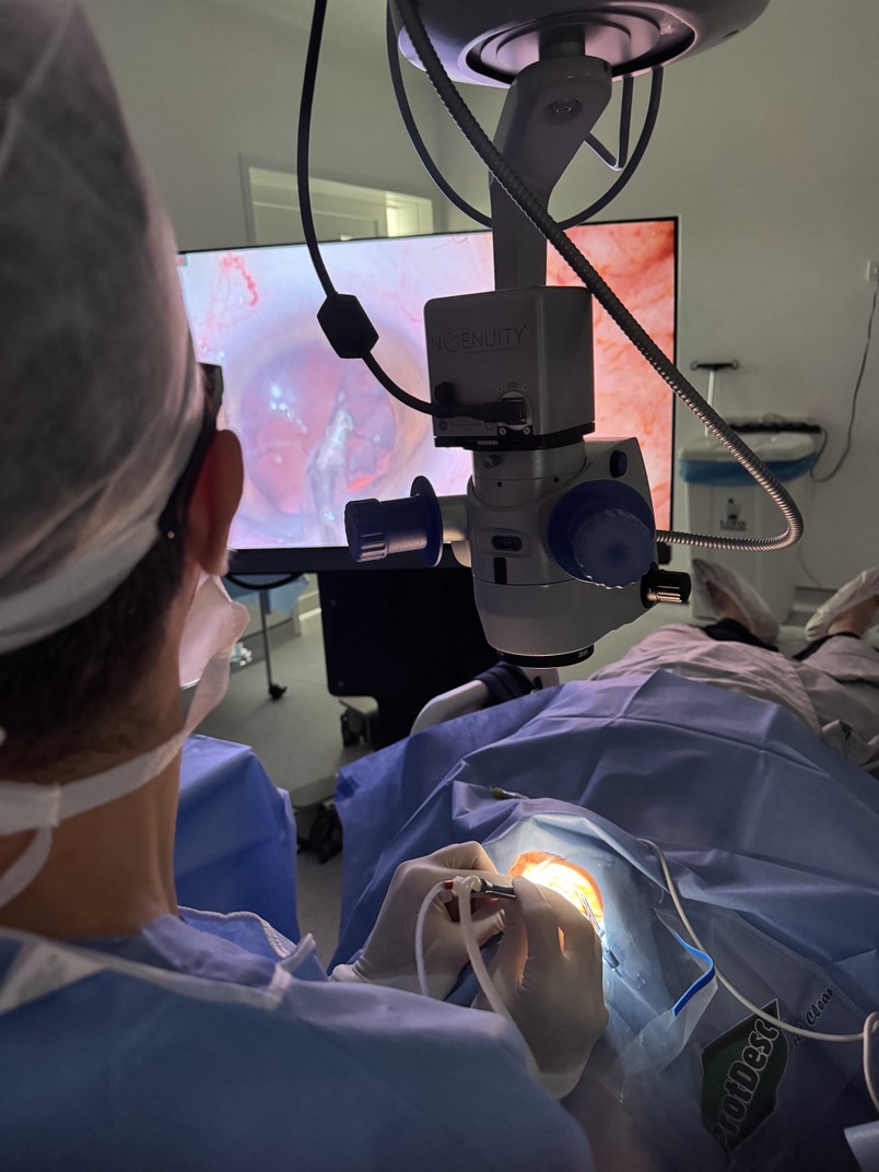 Dr. Gustavo Kalache realizando cirurgia de catarata ao microscópio