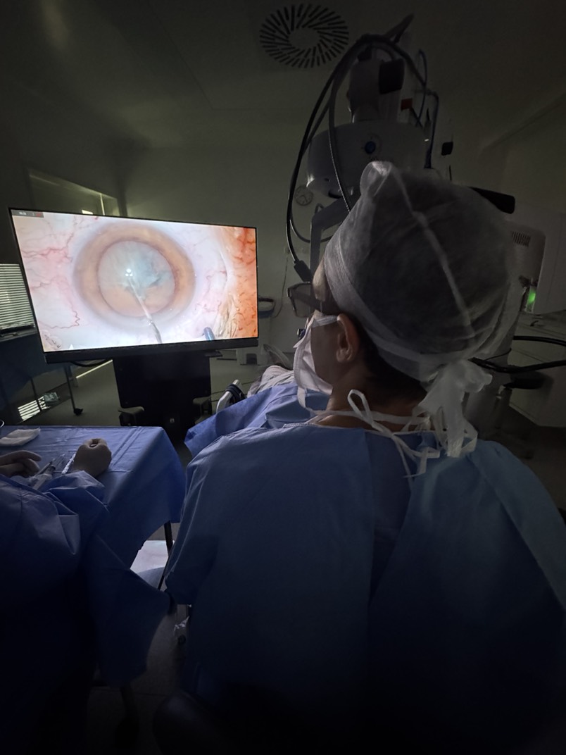 Dr. Gustavo Kalache durante cirurgia de catarata ao microscópio